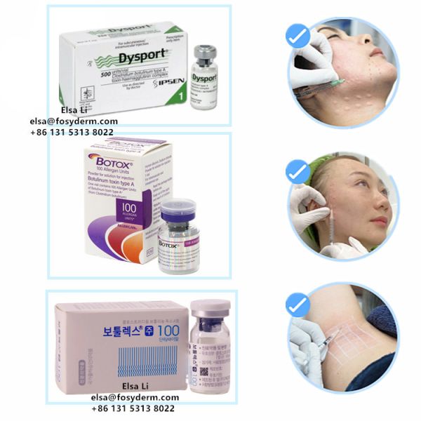 Hot Botox Injection Dysport for Removing Wrinkles Botulinum toxine