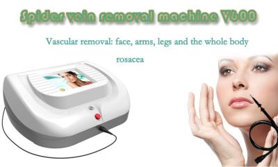 RBS 30MHZ high frequency facial skin veins removal skin tag removal machine