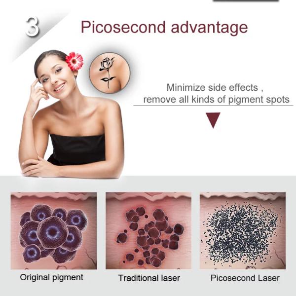 Pico Laser Q Switch Laser Machine для удаления татуировок всех цветов