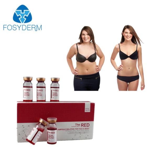 Ácido hialurónico injetável da solução do emagrecimento da lipólise de Fosyderm