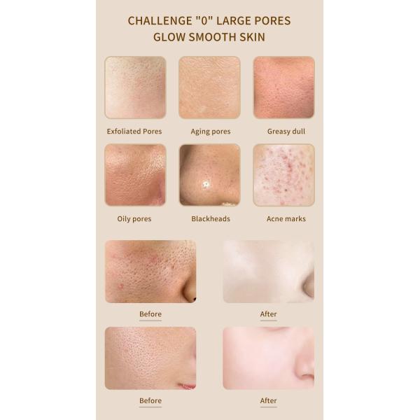 50 ml de suero de niacinamida para el refinamiento de los poros para aclarar la piel