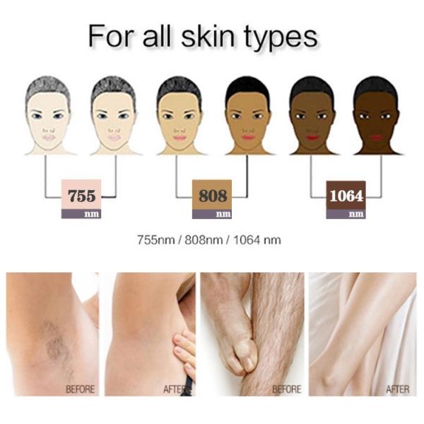 808nm Diode Laser Hair Removal Machine with Multi-Language Support and CE Certification