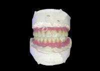 Dentistas con implantes dentales All-on-6 con estabilidad y comodidad