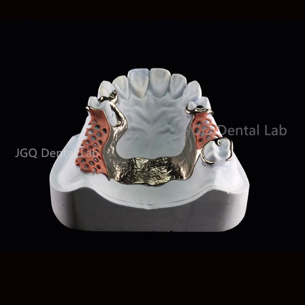3D Printing Titanium Dental Framework for Customized Removable Dentures