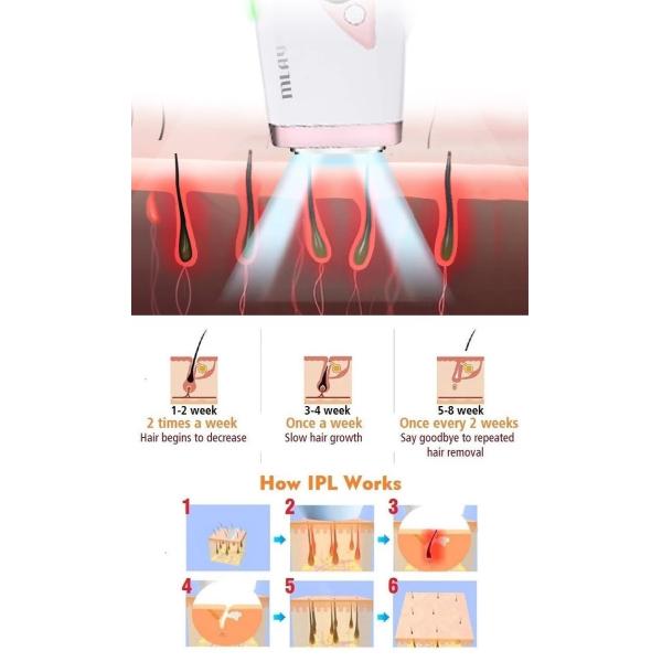 White 240V 3.5CM2 FCC FDA Approved IPL Hair Removal