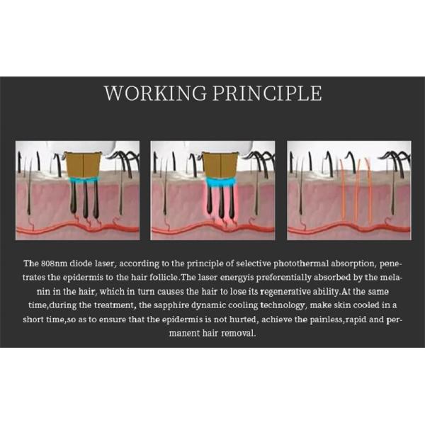 Устройство для удаления волос с помощью диодного лазера с длиной волны 3 808nm 755nm 1064nm