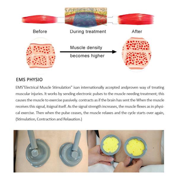 4 en 1 EMS máquina de onda de choque 448K máquina de terapia de vacío para dar forma al cuerpo