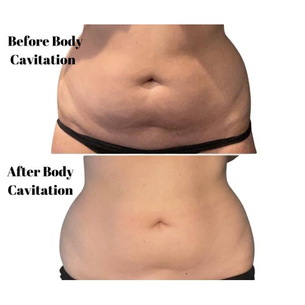 Ultrasound 4D Cavitation Slimming Machine Vacuum Body Cellulite Removal