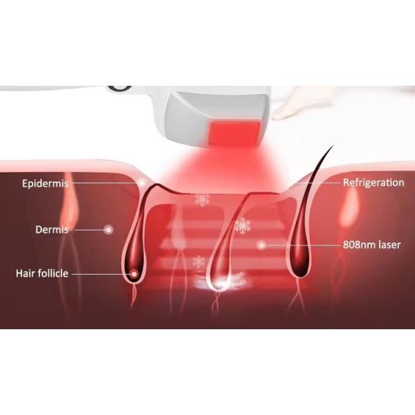 Super Power Titanium Case 1200w 808nm Diode Laser Hair Removal Machine