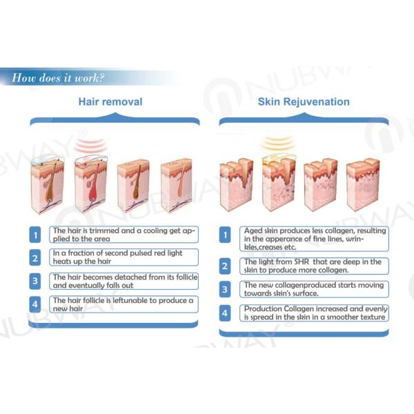 Germany medical use handle pipe whole body treatment opt shr ipl hair removal device