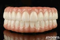 High Biocompatibility Ti-Bar Zirconia Hybrid Bridge For Precise Fit And Missing Teeth Replacement