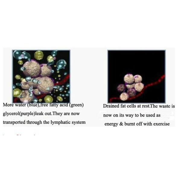 Vertical 1064 532 nm Q Switch ND YAG Laser Tattoo Removal Equipment