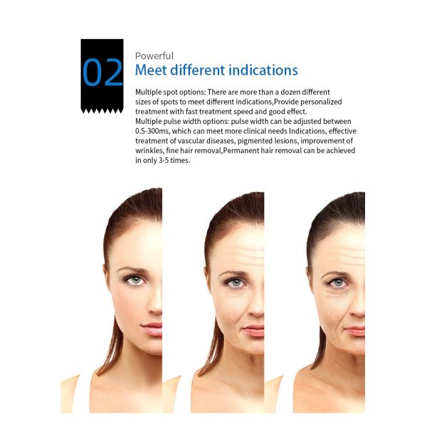 ND:YAG Laser Hair Removal Treatment Equipment 755nm 1064nm Long Pulse Laser Hair Reduction For Dark Skin