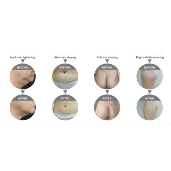 Quick Slim! Weight Loss Beauty Equipment RF Cavitation machine for sale