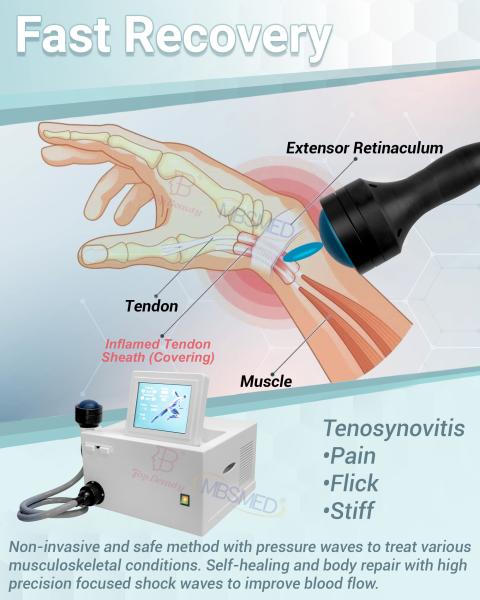 Electromagnetic Focused Shockwave Therapy Focus Shock Wave Fisioterapia Equipment