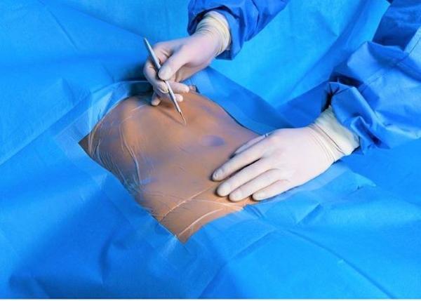 Hospital Sterile Surgical Abdominal Drape Sheet Disposable OEM Service