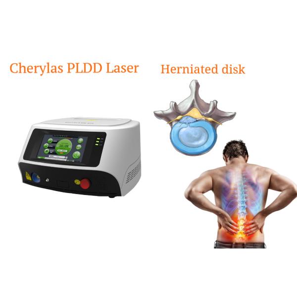Spinal Disc Herniation PLDD Laser Equipment Hardly Bleeding Local Anesthesia