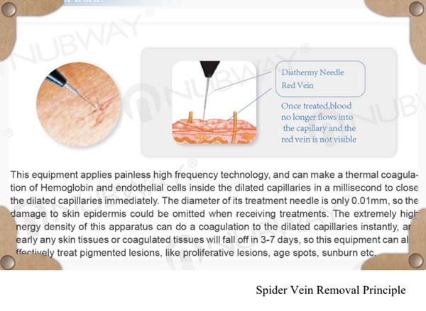 Painless safety high frequency 30MHZ spider vein removal and varicose vein treatment