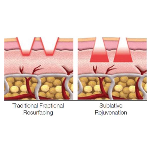 Инновационная технология восстановления кожи для всех типов кожи
