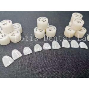 Fabricação personalizada de folheados de laboratório dentário laminados com alta resistência e resistência a manchas