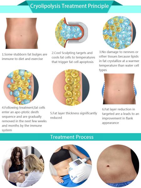 Vacuum Cellulite Therapy Body Slimming Cryolipolisis Machine Fat Freezing for clinic