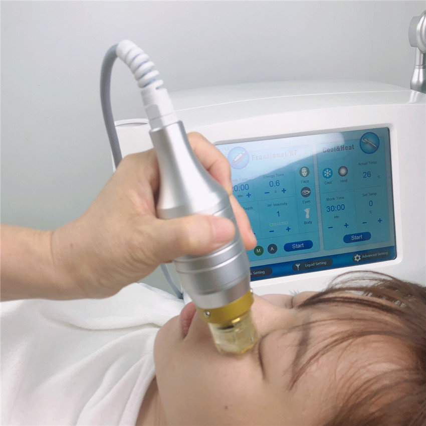 Степень Microneedling Frational RF удаления 45 меток Strectch