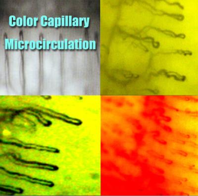 Microscopia capilar do Nailfold do hospital/função microscópio do Microcirculation multi para médico