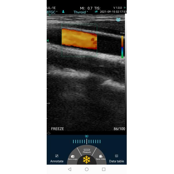 Зонд IPhone 7.5MHz USB Wifi блока развертки ультразвука кармана Doppler цвета линейное
