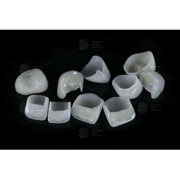 0.3mm-0.7mm Feldspathic EMAX Ceramic Veneers Natural Aesthetic Emax Dental Veneers