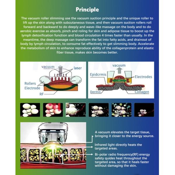 Vacuum Roller Body Shaping Lymphatic Drainage Slimming Body Contouring Machine