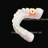 Dental Lab Durability Implants Make Cost-Effective Option in The Long Run