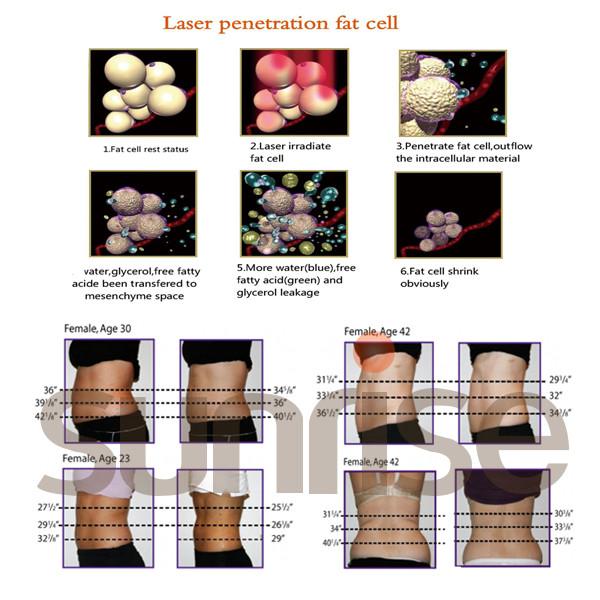 Beijing sunrise 940nm weight loss body slimming machine 650nm lipo laser
