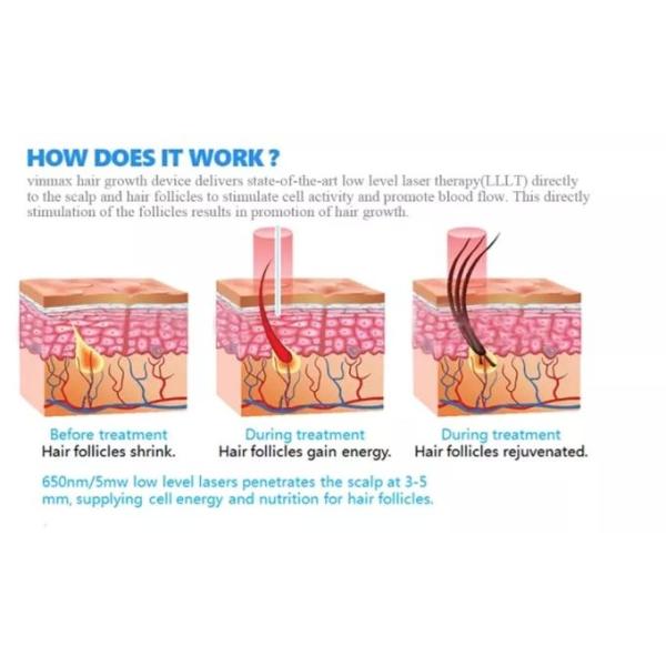 5W Home 660NM Hair Growth Massage Comb