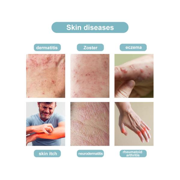 Multifunction Back Knee Joint Pain Relief Soft Cold Laser Therapy Machine