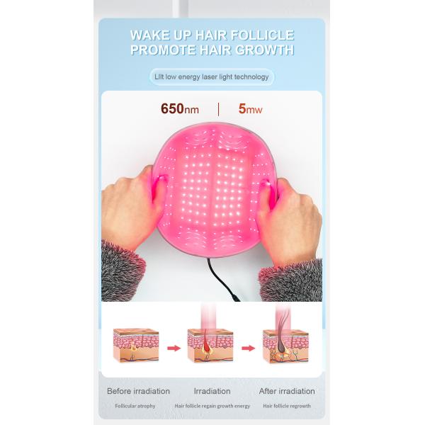 650nm Laser Helmet For Baldness Prevent Treatment Thicker Hair Regrowth