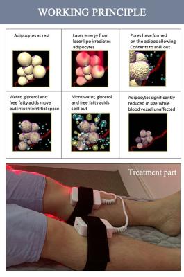 980nm Lipo Laser Slimming Machine for Fat Burning Anti Cellulite