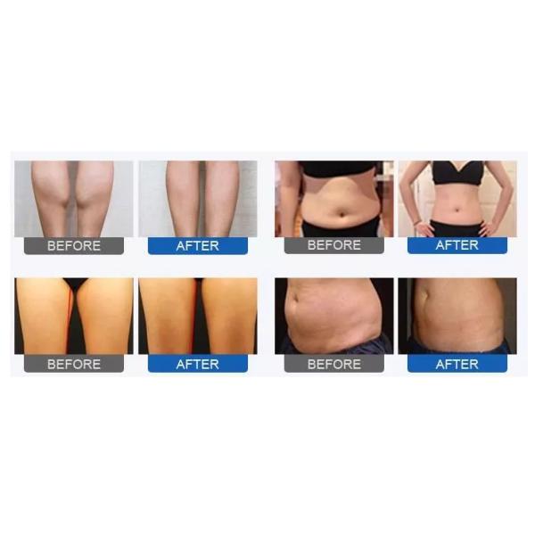 Air Pressure Wave Slimming Machine with Trousers Cellulite Removal Presoterapia Legs Detox Slimming Machine