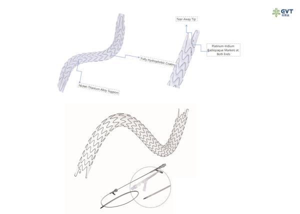 Large Lumen Urethral Stent Hydrophobic Nitinol Design For Precision Placement