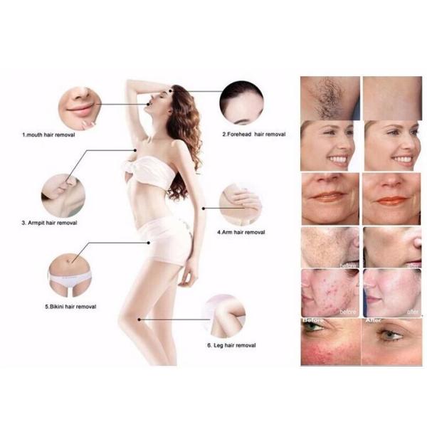 Clinic And Hospital Elight Hair Removal Machine / SHR IPL Hair Removal Device