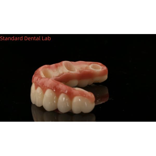 Porcelain All On Four Zirconia Bridge High Esthetics Dental Implant Bridge Screw Retained