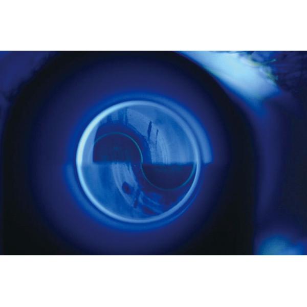 Portable non contact tonometer/NCT/rebound tonometer