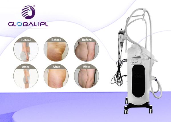 RF Diode Laser Cryolipolysis Machine 4 In 1 Body Slimming Machine For Salon