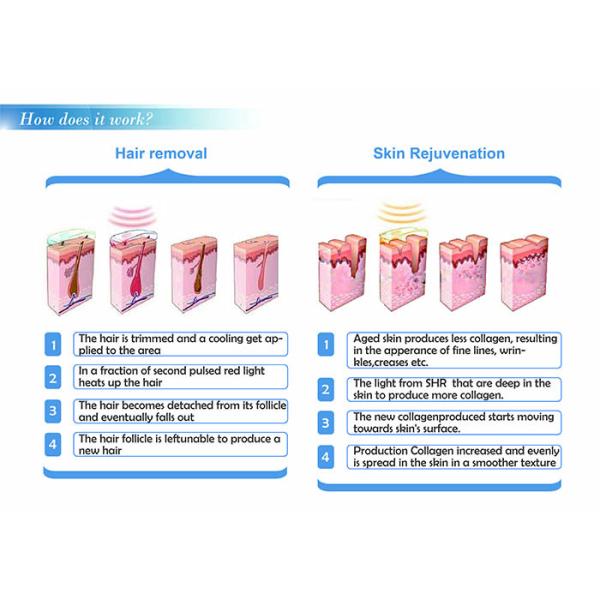 Elight SHR IPL Laser Hair Removal Machine With CE