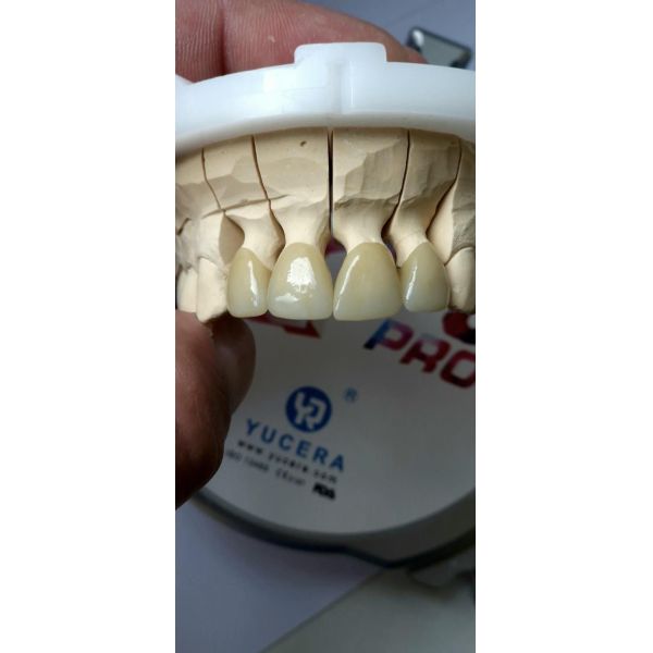 Yucera 4D Pro Zirconia Dental Whole Sale Multilayer Zirconium Disc Ceramic  for Cad Cam High Transmittance