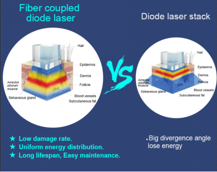 Машина удаления волос лазера диода Painess 3 пар волокна длины волны для салона красоты