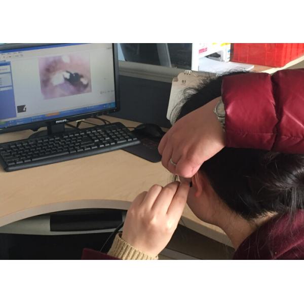 USB Endoscope Household for Inspection Ear by Yourself with Resolution 640 * 480 USB 2.0 Interface