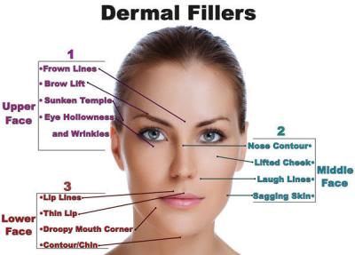 Derm Deep Hyaluronic Acid Fillers Nasolabial Folds / Hyaluronic Acid Gel Injection With Li