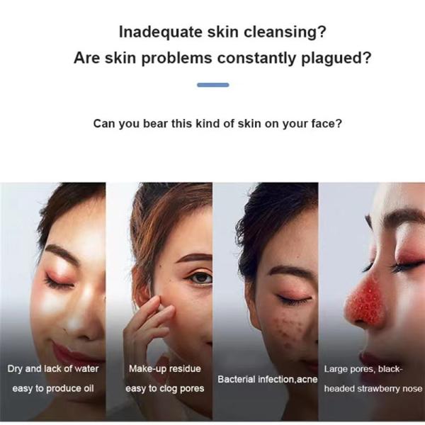 Vacuum Suction Blackhead Remover Pore Cleaner for Face Cleaning and Acne Removal Kit