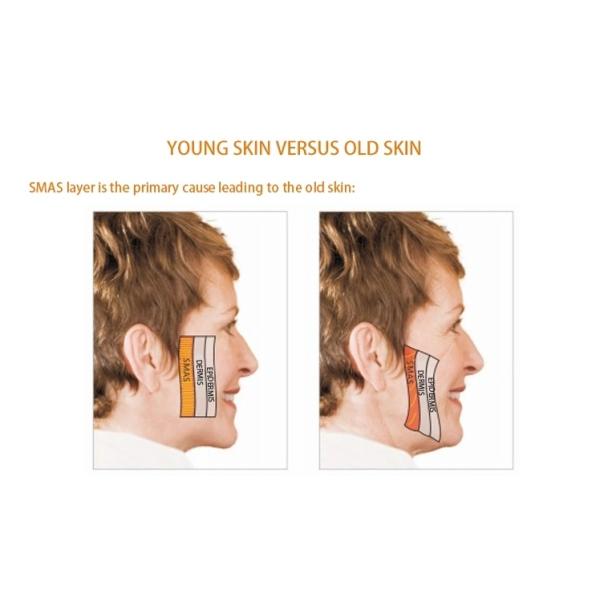 Оборудование красоты удаления 110в 220в РФ морщинки подниматься стороны