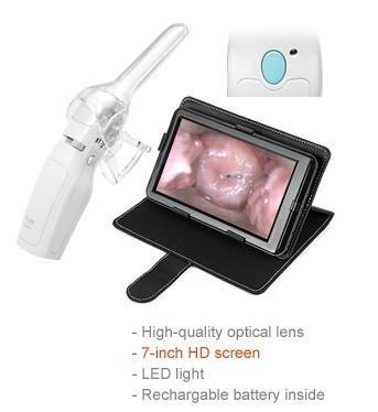 Digital Endoscope Self-Inspect Colposcope Mini Colposcopy with Range of Observation 70~100mm